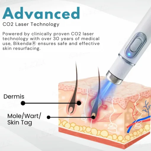 Bikenda® Non-Invasive Mole and Wart Removal Laser Pen