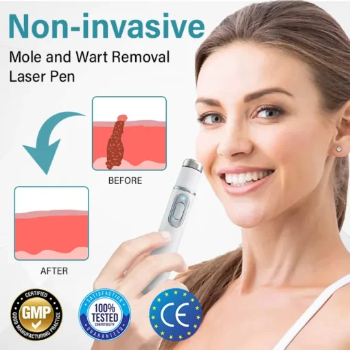 Bikenda® SpotAway Painless Laser Mole Removal Pen
