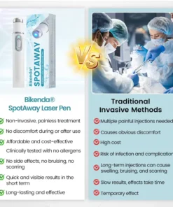 Bikenda® SpotAway Painless Laser Mole Removal Pen