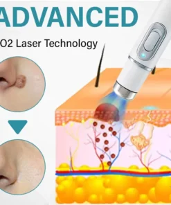 Bikenda® SpotAway Painless Laser Mole Removal Pen