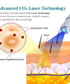 DAFEILA® LumeSkin Mole and Wart Removal Laser Pen
