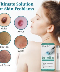 Slimoly™ LumeSkin Mole and Wart Removal Laser Pen
