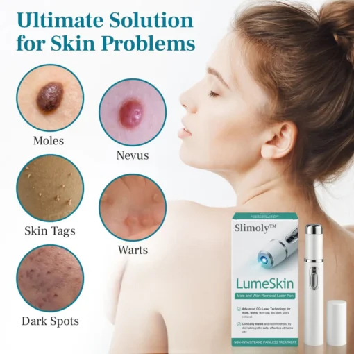 Slimoly™ LumeSkin Mole and Wart Removal Laser Pen