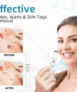 𝗞ı𝗱s𝗻𝗲𝗲𝗱® 𝗡𝗼𝗻-𝗜𝗻𝘃𝗮𝘀𝗶𝘃𝗲 𝗠𝗼𝗜𝗲 𝗮𝗻𝗱 𝗪𝗮𝗿𝘁 𝗥𝗲𝗺𝗼𝘃𝗮𝗜 𝗜𝗮𝘀𝗲𝗿 𝗣𝗲𝗻