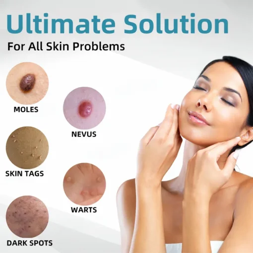 𝗞ı𝗱s𝗻𝗲𝗲𝗱® 𝗡𝗼𝗻-𝗜𝗻𝘃𝗮𝘀𝗶𝘃𝗲 𝗠𝗼𝗜𝗲 𝗮𝗻𝗱 𝗪𝗮𝗿𝘁 𝗥𝗲𝗺𝗼𝘃𝗮𝗜 𝗜𝗮𝘀𝗲𝗿 𝗣𝗲𝗻